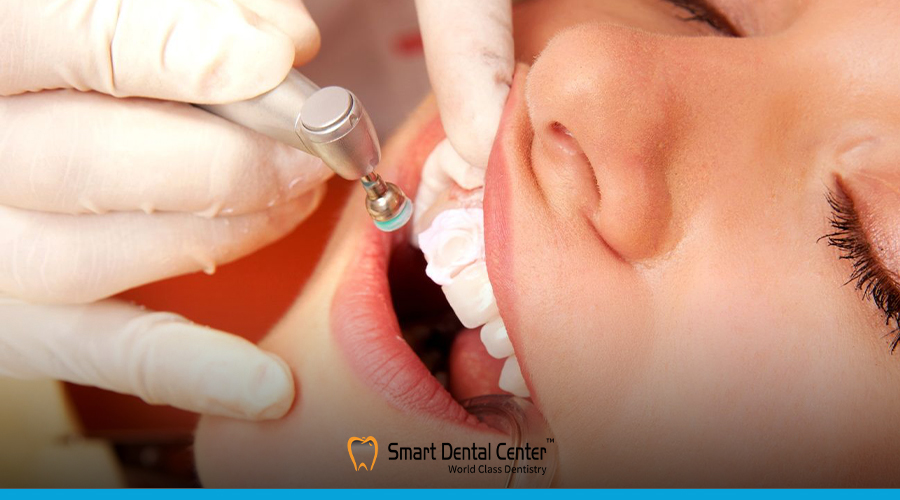 تكلفة تجميل الاسنان فى مصر