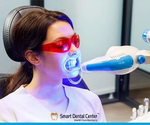 تبييض الاسنان بالليزر