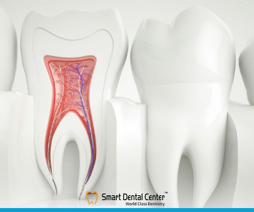 هل حشو العصب مؤلم