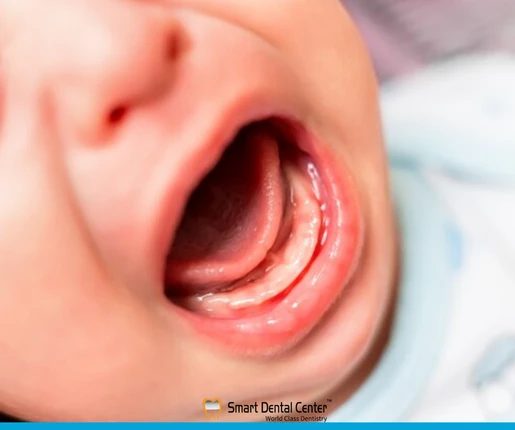 اعراض التسنين عند الاطفال