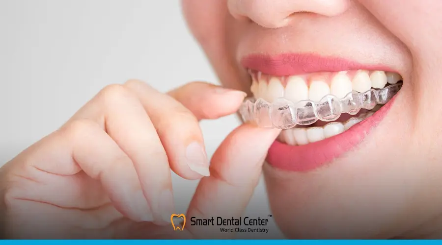 تقويم الأسنان الشفاف
